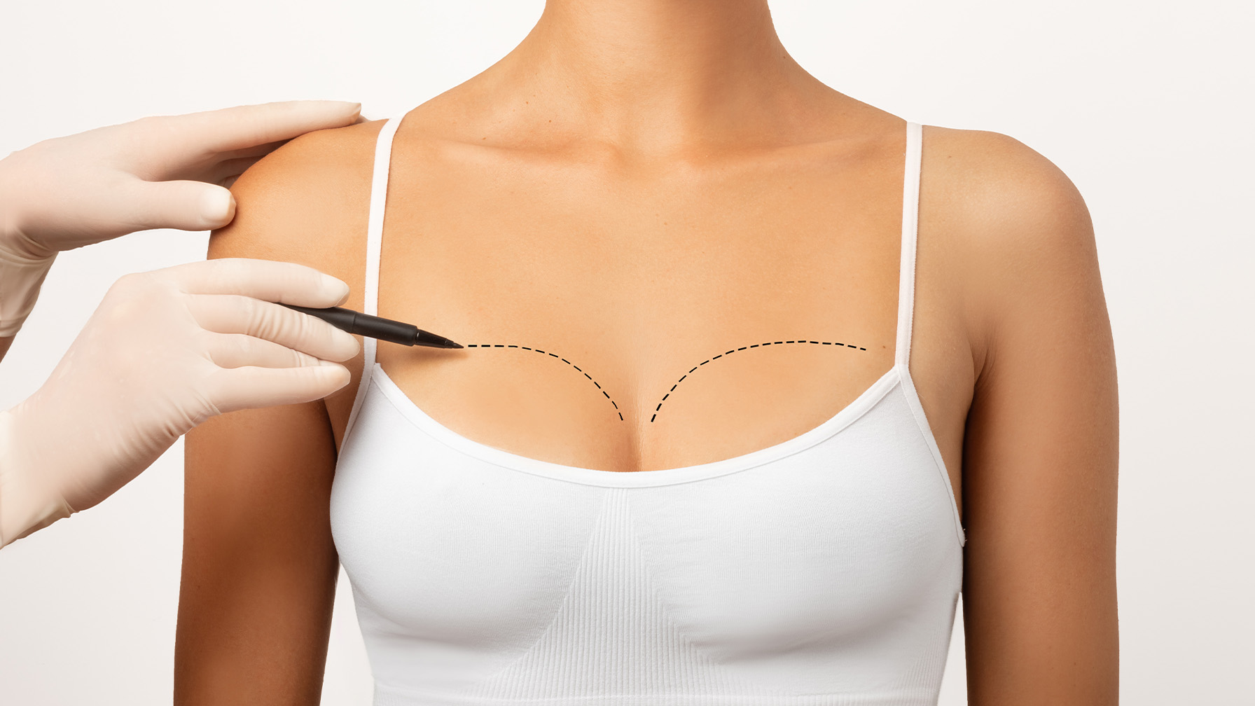 Kapsül Kontraktürü Tedavisi